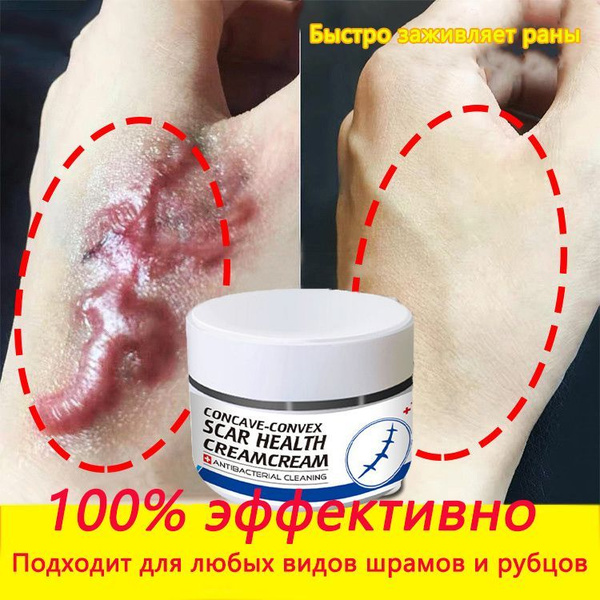 крем от шрамов и рубцов от растяжек для беременных быстрая починка ...
