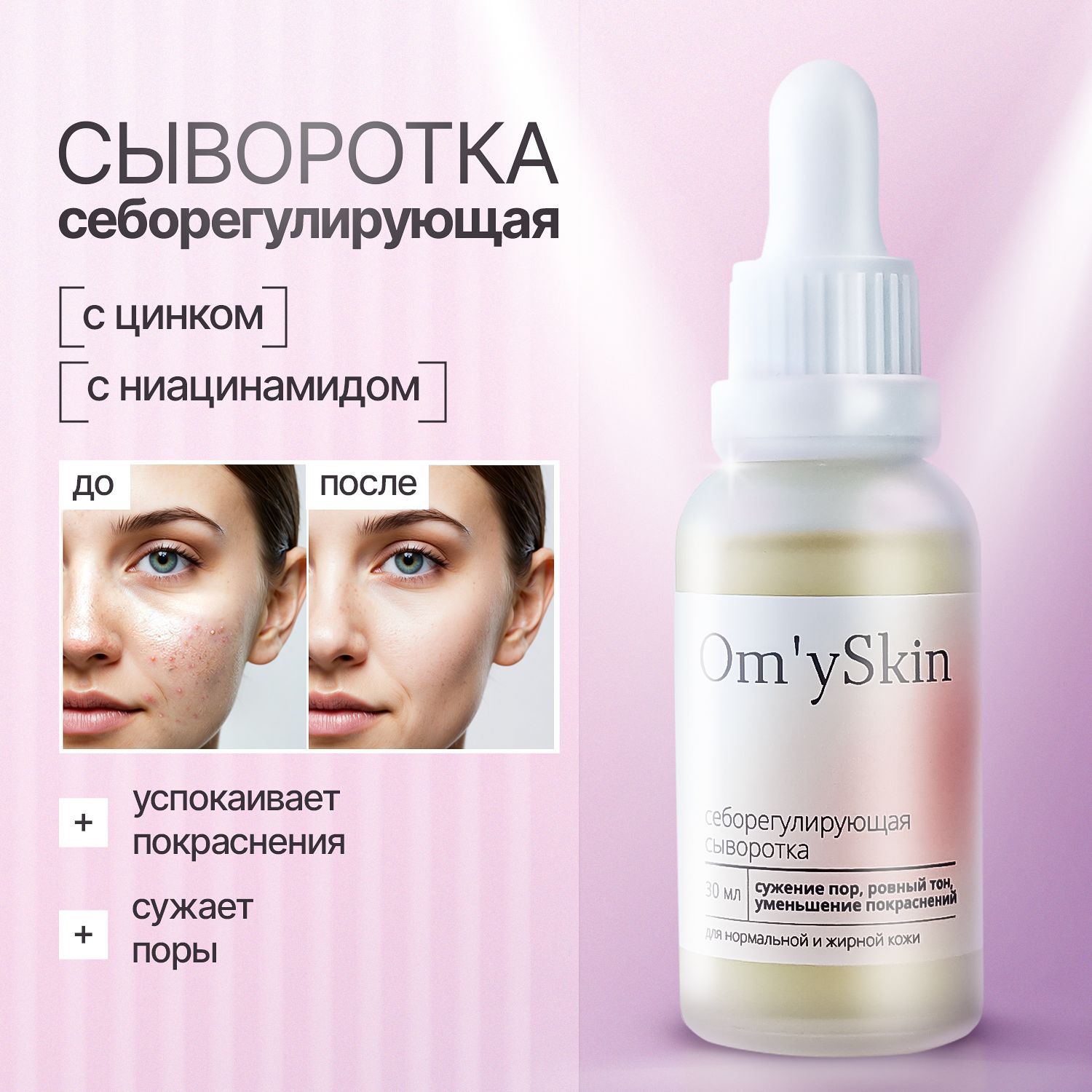 Om'ySkin Сыворотка для лица себорегулирующая от прыщей и постакне с цинком, ниацинамидом и центелла, 30 мл