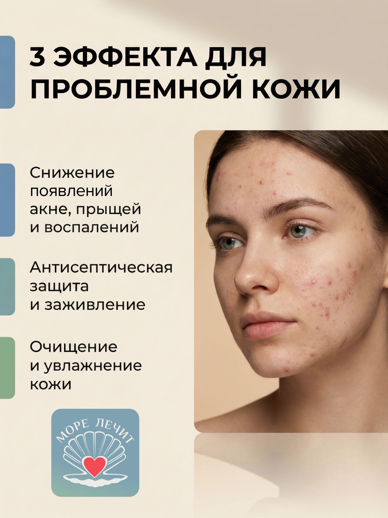 Крем улиточный КАК ИЗБАВИТЬСЯ ОТ АКНЕ?
