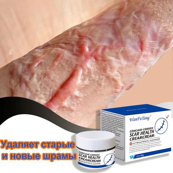 Средство от растяжек купить на OZON по низкой цене (1773414556)
