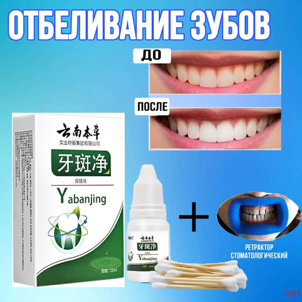 Отбеливание зубов ONE MOMENT гель для домашнего отбеливания зубов, 10 ...
