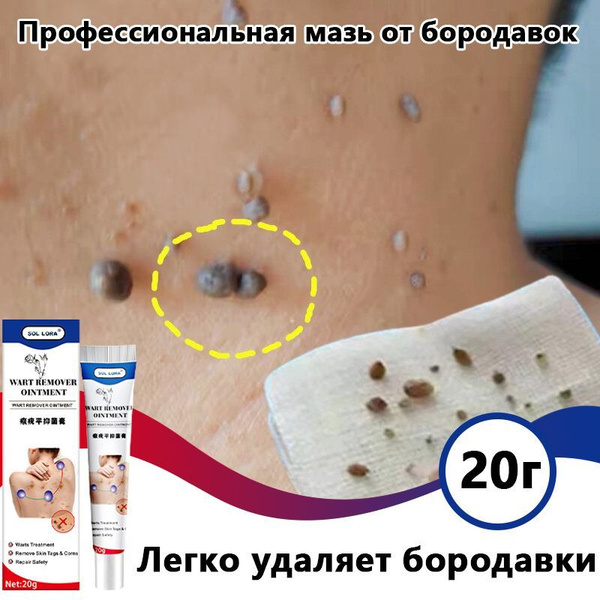 Средство для удаления бородавок, 20 мл от сухих мозолей, папиллом и ...