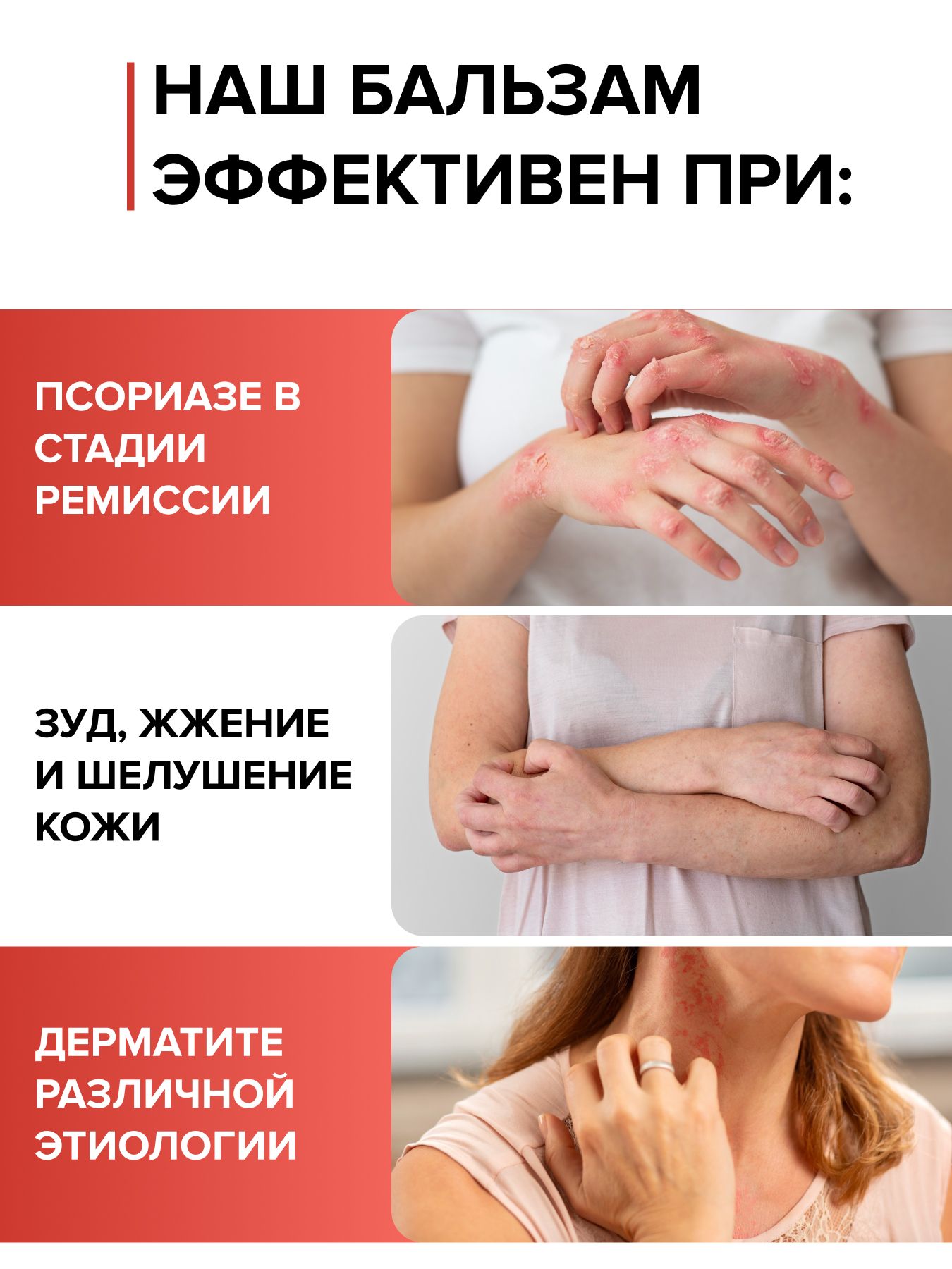 Бальзам Целебный Алтай Панты марала при псориазе