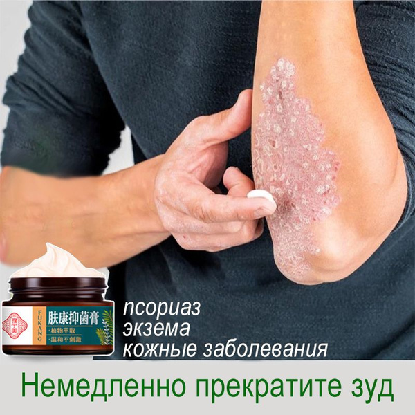Противозудная мазь , 30 г, для антибактериального и противозудного ...