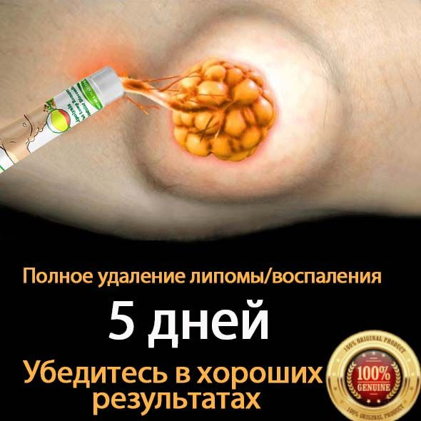Мазь от липом и жировиков,твердые комки,крем для облегчения приподнятых ...