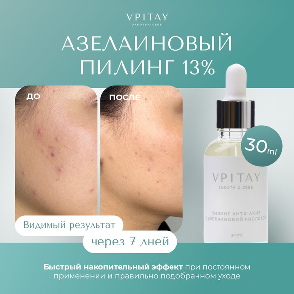 Пилинг для лица кислотный профессиональный с азелаиновой кислотой анти ...