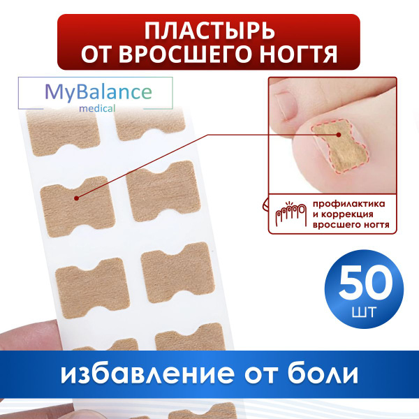 Пластырь MyBalance от вросшего ногтя, 50 шт, цвет бежевый купить на ...