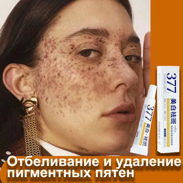 Крем для отбеливания и удаления веснушеk,50g, для удаления веснушек ...