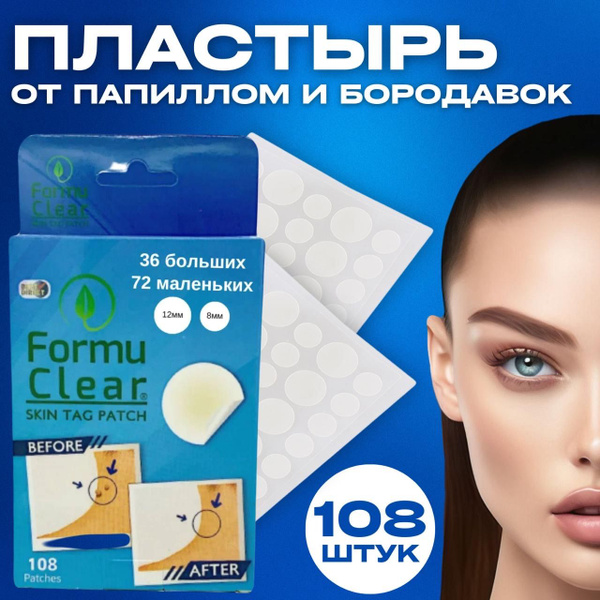 Пластырь от папиллом, патчи от прыщей, средство от бородавок, родинок и ...