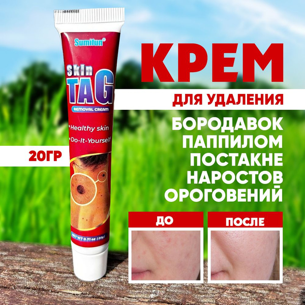 Крем от папиллом и бородавок - купить с доставкой по выгодным ценам в ...