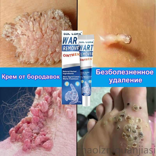 Вопросы и ответы о Мазь от бородавок / 60г, Безопасное и безболезненное ...