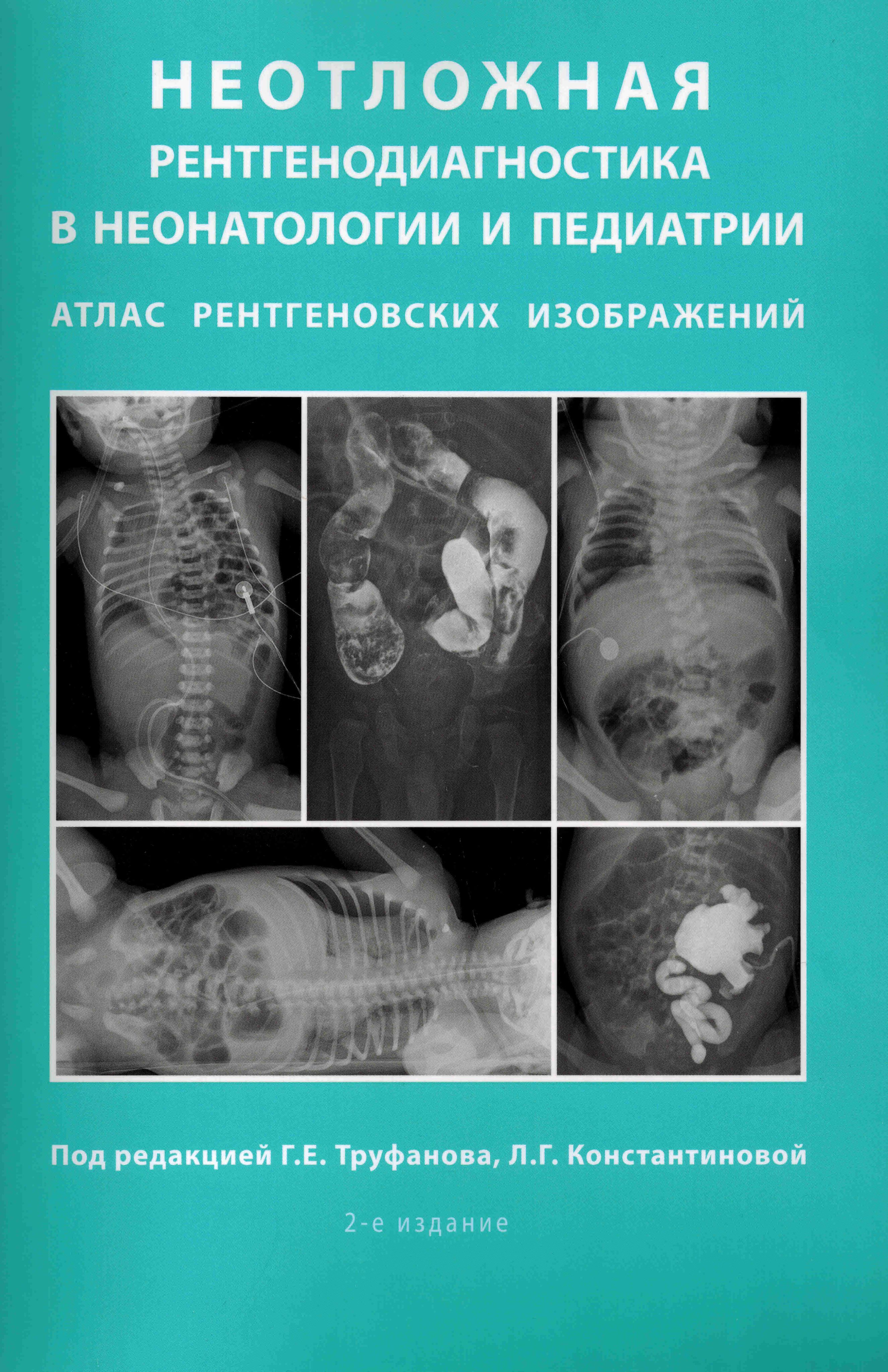 Неотложная рентгенодиагностика в неонатологии и педиатрии: атлас  рентгеновских изображений