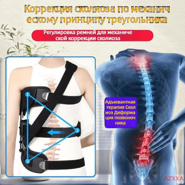 Медицинский сколиозный фиксатор поясничного отдела позвоночника, ортез ...