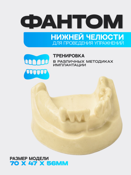 Денто - модель нижней челюсти с частичной адентией купить на OZON по ...