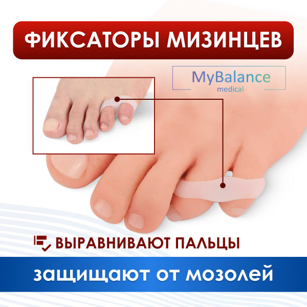 Фиксатор мизинца стопы MyBalance с межпальцевым разделителем - купить с ...