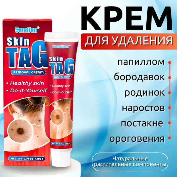 Средство от папиллом и бородавок, мазь от папиллом, крем от родинок ...
