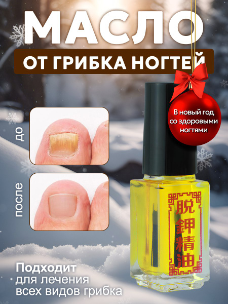 Средство против грибка ногтей на ногах и руках / средство от грибка ...