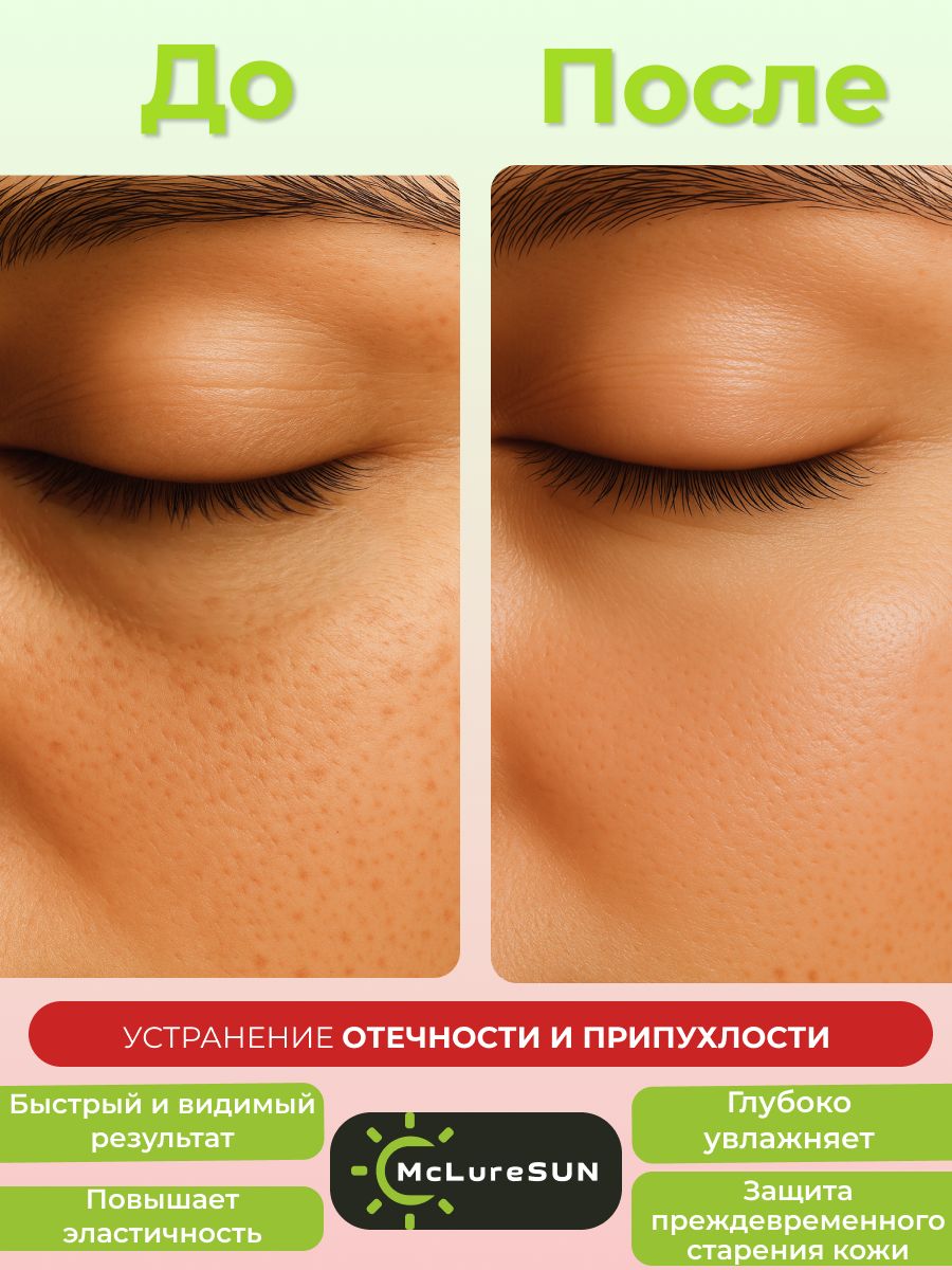 McLureSun Жидкие патчи для глаз от отеков и темных кругов, с маклюрой и экстрактом алоэ, 50 мл