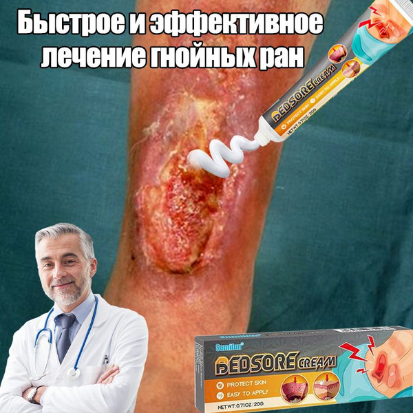 Мазь от пролежней/заживляющий гель для ран и ожогов/для лечения ран ...
