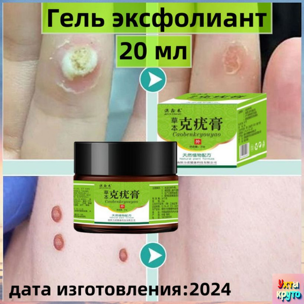 Клареол гель от папиллом / Гель эксфолиант, Крем от бородавок 20 мл ...
