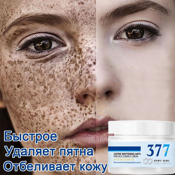 Крем для отбеливания веснушек, осветление пигментных пятен ...