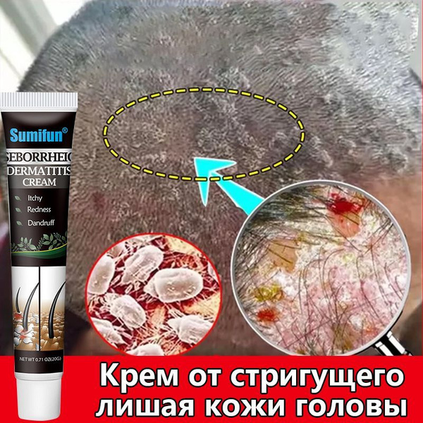 Крем от стригущего лишая кожи головы 20 г против дерматита фолликулита ...