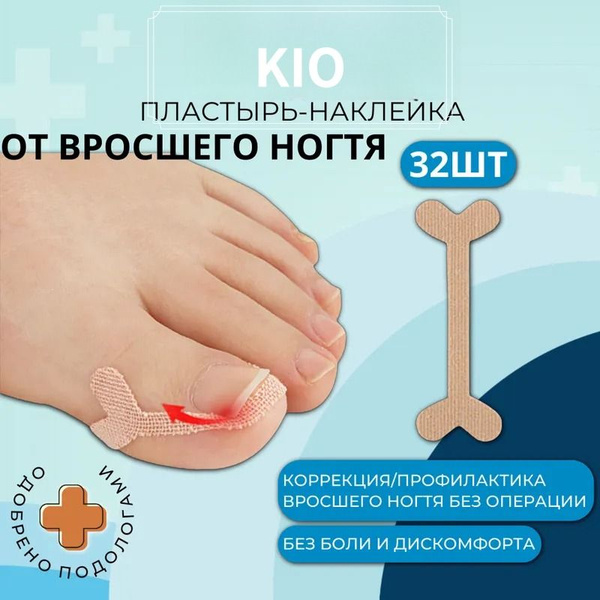 От вросшего ногтя пластырь - корректор наклейки ЕКМ, при врастании ...
