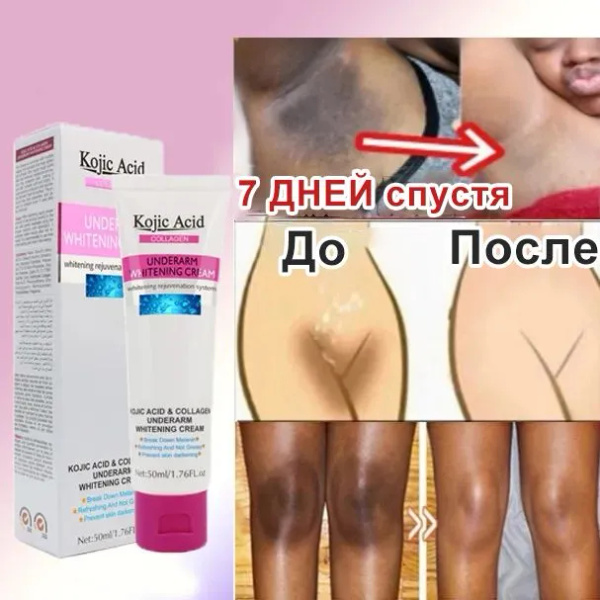 Отбеливающий крем для тела, подмышек, интимных зон, локтей, коленей, от ...