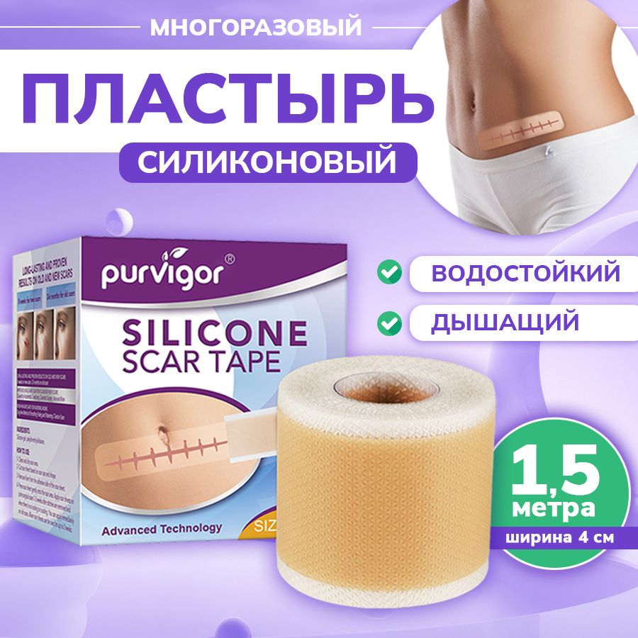 Силиконовыйпластырьотшрамовирубцов4х150см