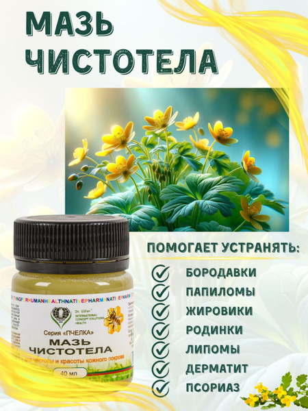 Мазь ЧИСТОТЕЛА от псориаза, от бородавок, папиллом / От прыщей - купить ...