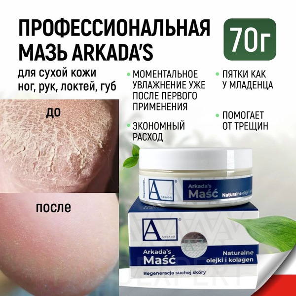 Аркада мазь 70 г, для сухой кожи ног, рук, от трещин, мозолей ...