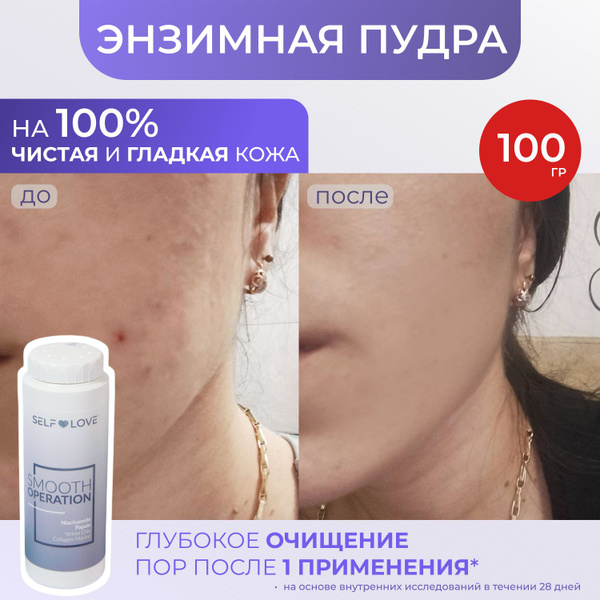 Энзимная пудра. Энзимная пудра с ниацинамидом. 100 гр - купить с ...