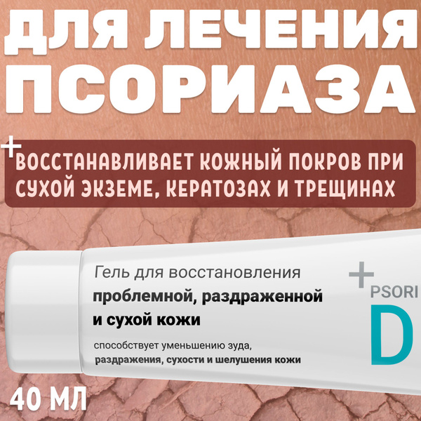 Натуральный негормональный гель крем для восстановления кожи от трещин ...