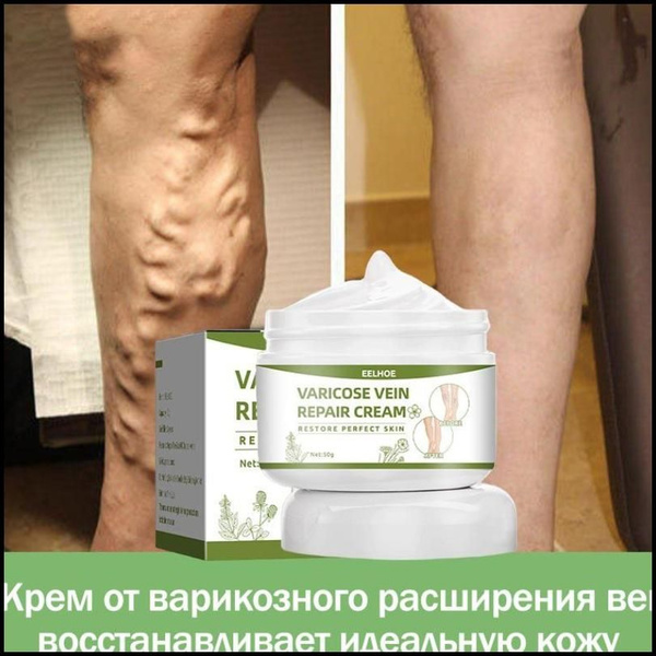 Крем для лечения варикозного расширения вен 50г Эффективное средство ...
