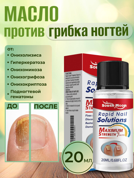 Масло для ногтей от грибка, средство для лечения грибка, "Rapid", 20 мл ...