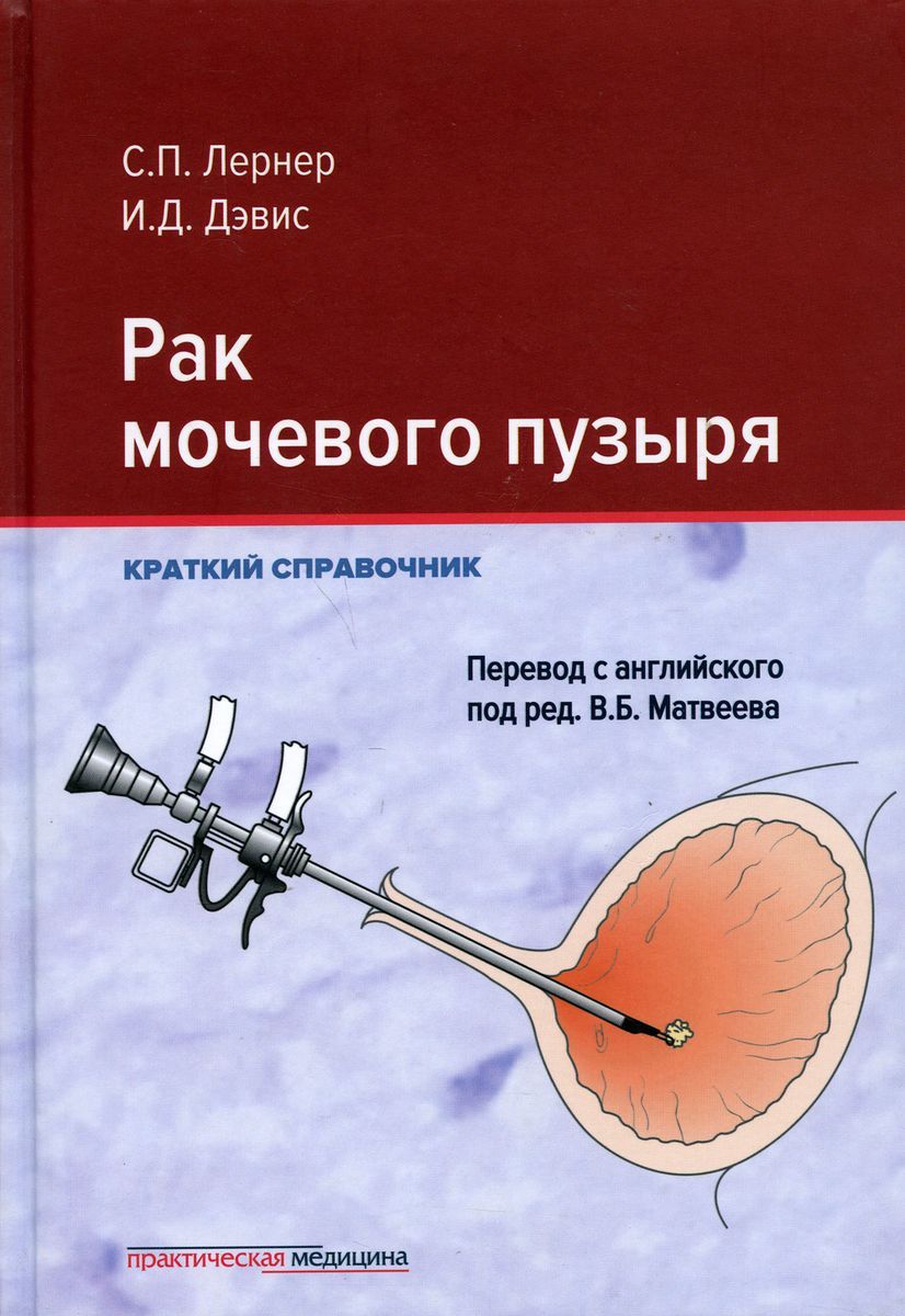 Рак мочевого пузыря лечение в израиле. Мочевой пузырь. диагноз дискинезия мочевого пузыря. справочник гинеколога эндокринолога тумилович. экстрофия мочевого пузыря у детей.