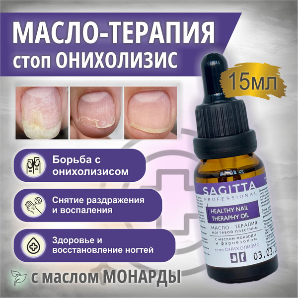 Масло-терапия ногтевой пластины СТОП ОНИХОЛИЗИС Sagitta 15 мл - купить ...
