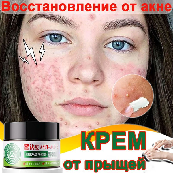 Крем от прыщей и акне, Содержит салициловую кислоту, азелаиновую ...