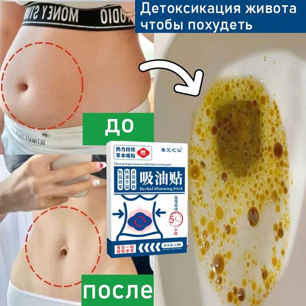 Пластырь для похудения на живот детокс Жиросжигающий В одной упаковке ...
