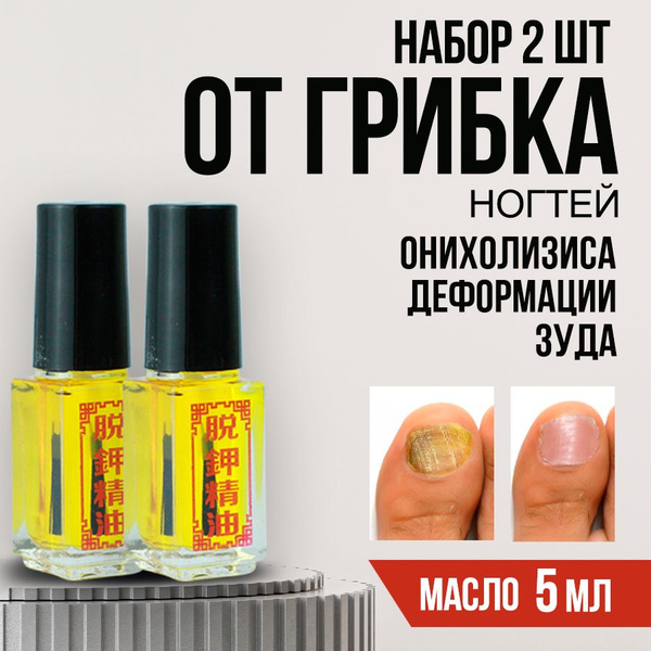 Средство от грибка ногтей на ногах, SilaVeres, лечение онихолизиса, 2х5 ...