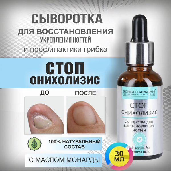 Сыворотка Стоп Онихолизис для лечения и восстановления ногтей с маслом ...