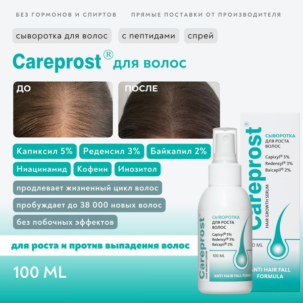 Сыворотка против выпадения и для роста волос Careprost (Карепрост ...