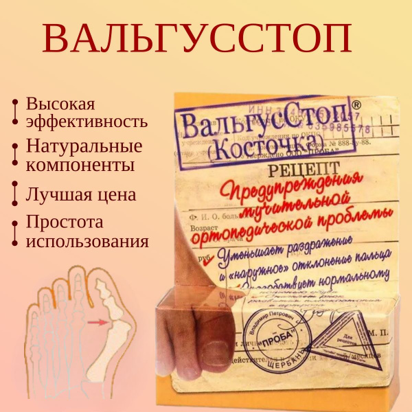 "ВАЛЬГУССТОП" КРЕМ для стоп (Косточка)/ Мазь от вальгусной деформации ...