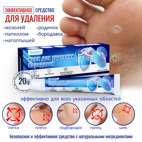 Средство от мозолей и натоптышей на ногах, крем-гель от папиллом и ...