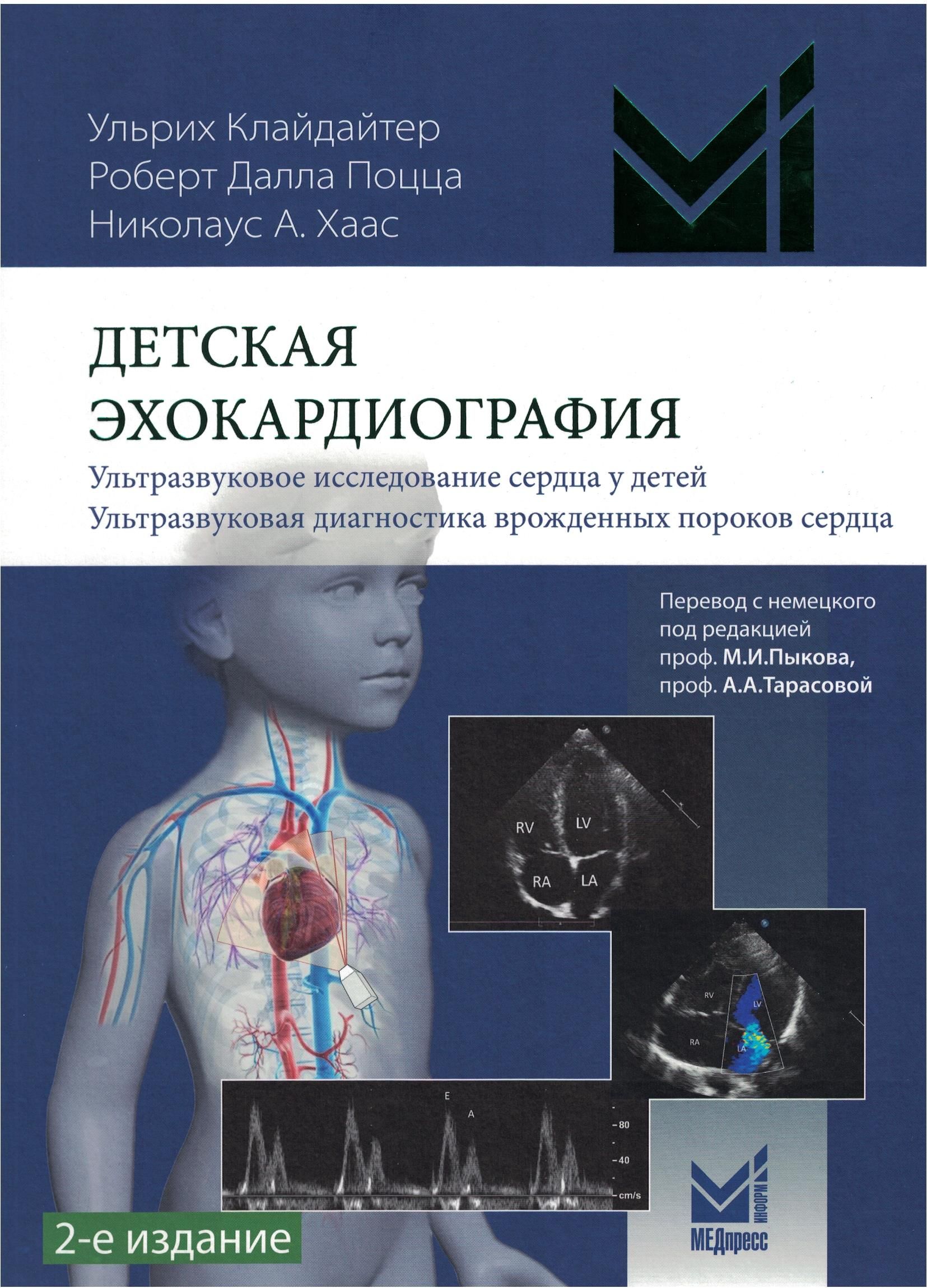 Узи сердца муром. Эхокардиография клайдайтер Ульрих. Книги по эхокардиографии. Детская эхокардиография. УЗИ сердца.