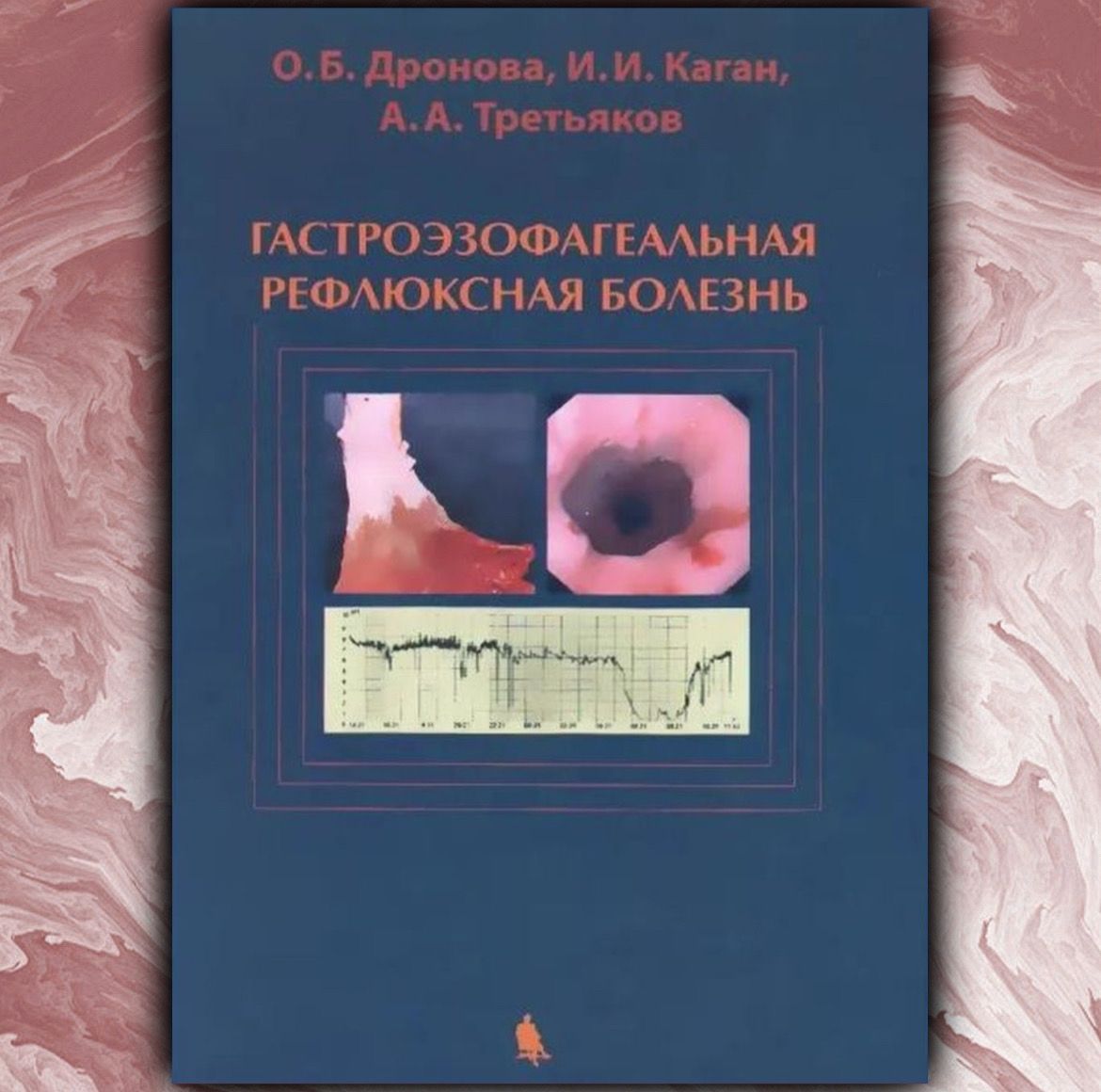 Гастроэзофагеальная рефлюксная болезнь. Дронова Ольга Борисовна, Третьяков Анатолий Андреевич | Дронова Ольга Борисовна, Каган Илья Иосифович