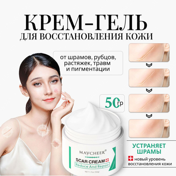 Крем-гель от шрамов, рубцов, растяжек, травм и пигментации, мазь от ...