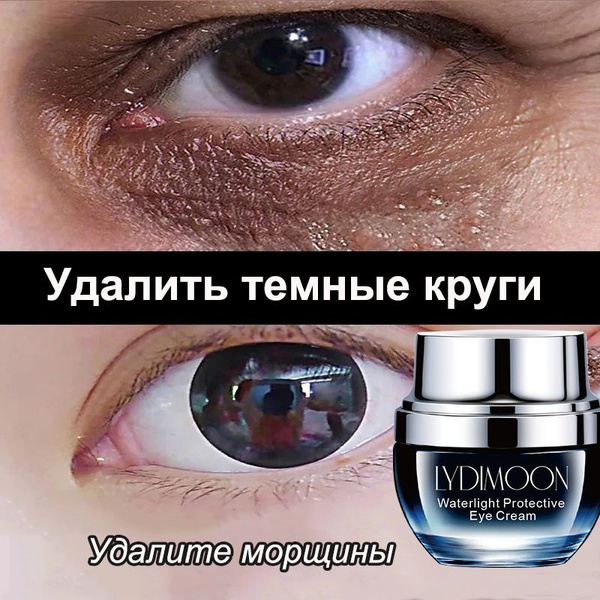 LYDIMOON Крем для век антивозрастной,30 г,отеков вокруг глаз и темных ...