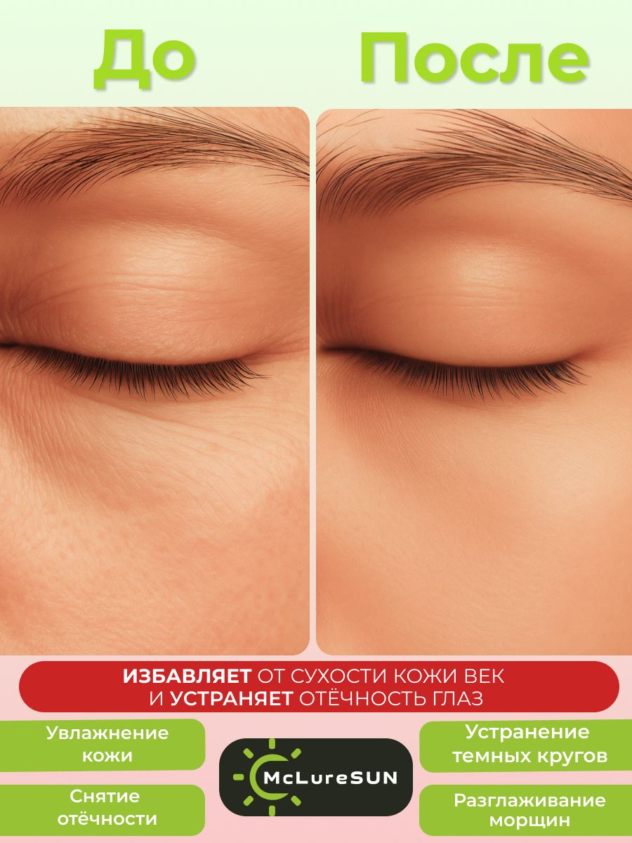 McLureSun Бальзам-крем для век от отеков с маклюрой и пептидом змеиного яда, 30 мл