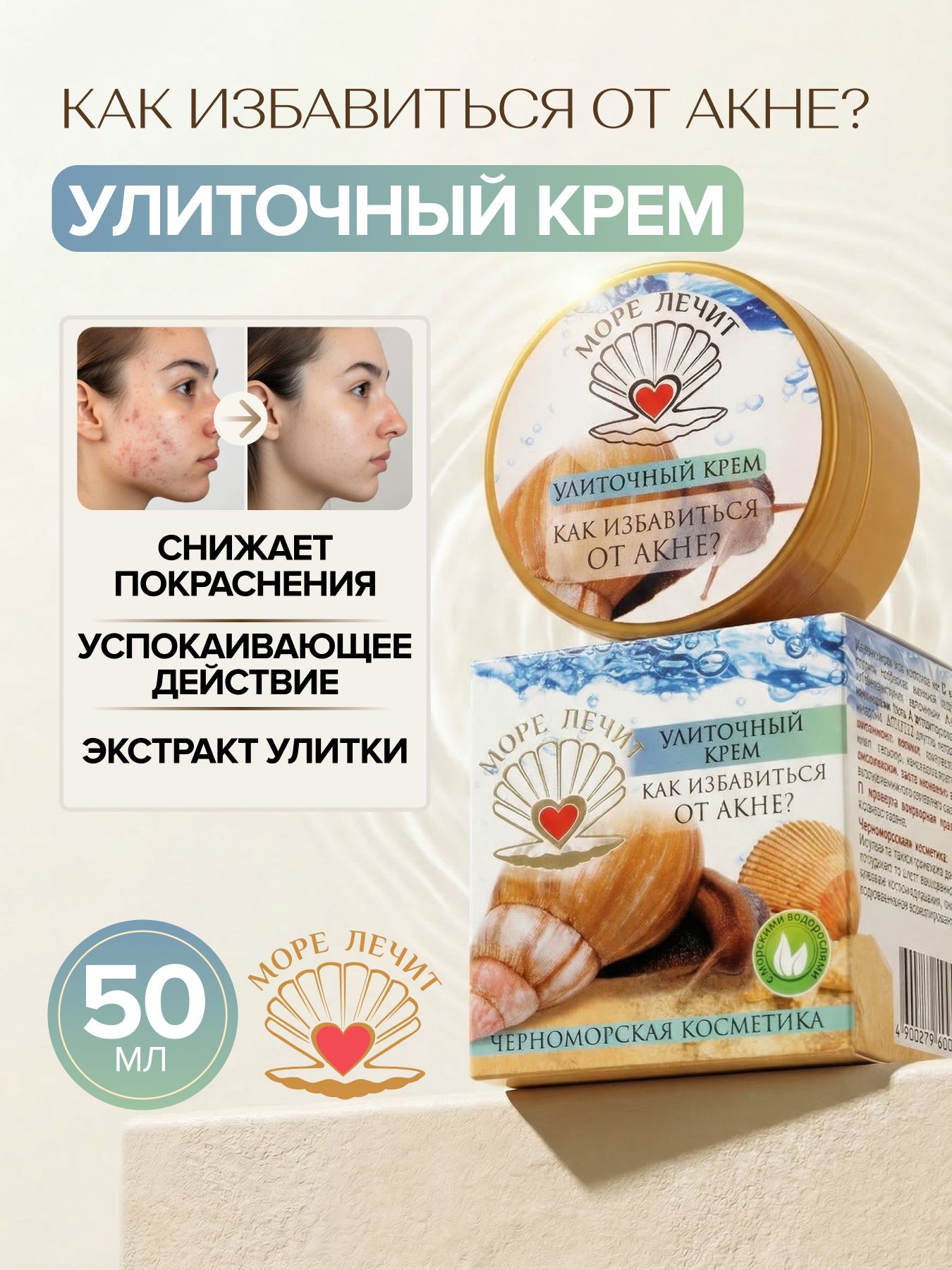 Крем улиточный КАК ИЗБАВИТЬСЯ ОТ АКНЕ?